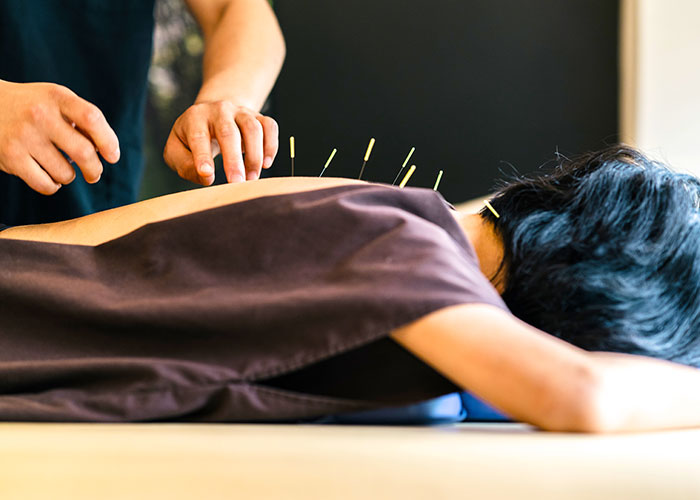 鍼治療